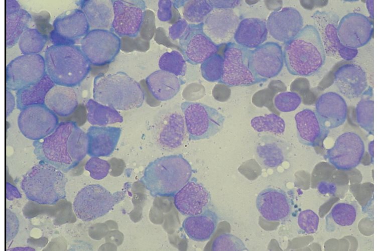Bone marrow models