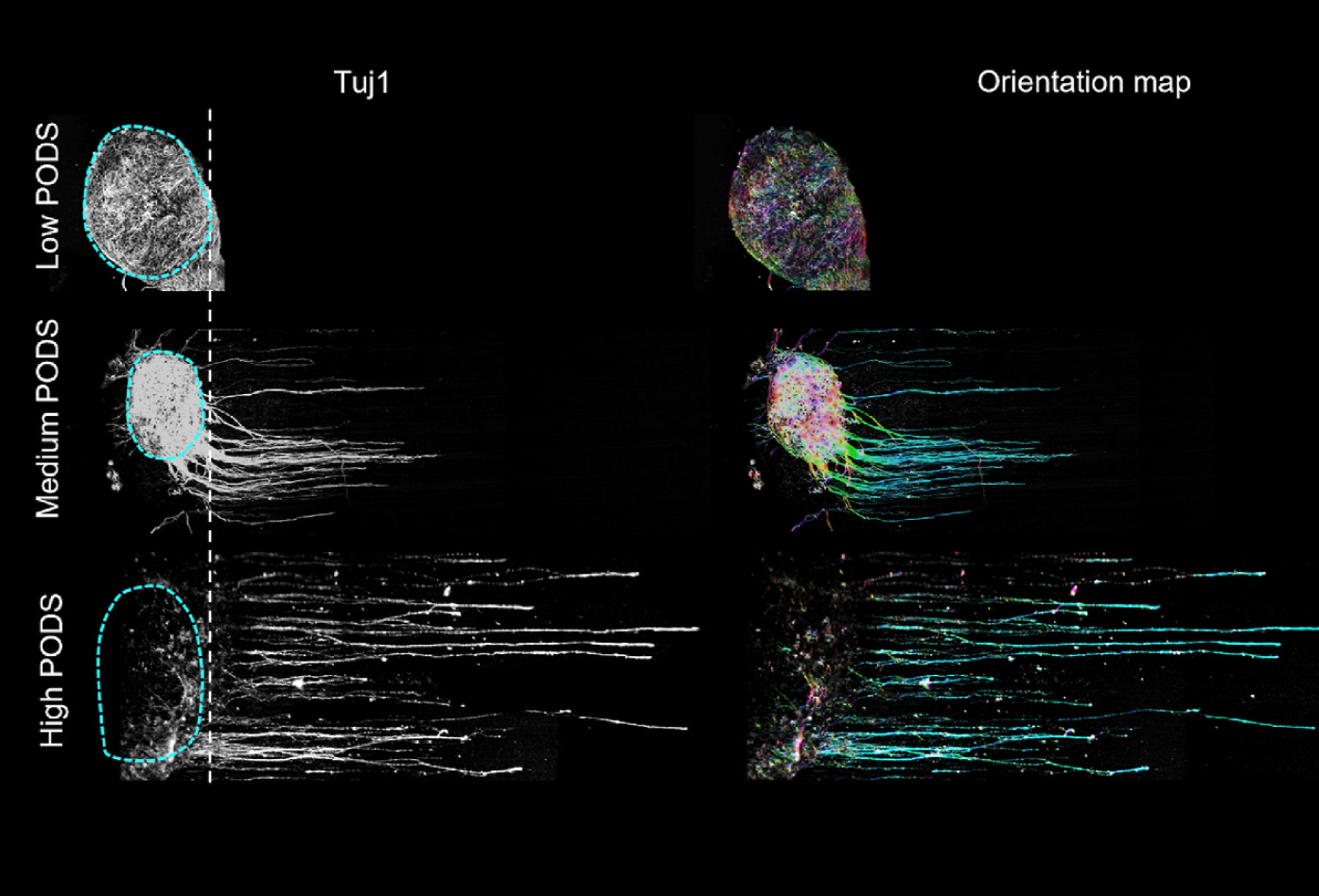 Sustained-release growth factors for nerve repair conduits