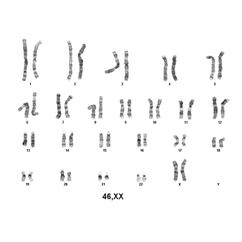 Karyotype service for fixed cells