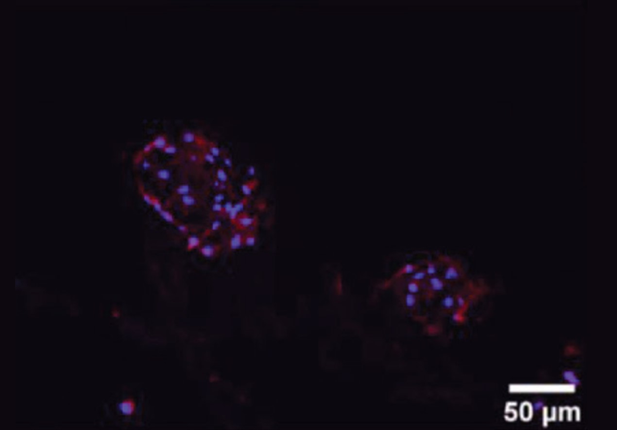 Using PeptiInk&reg; Alpha-1&#8482; for bioprinting chondrocytes