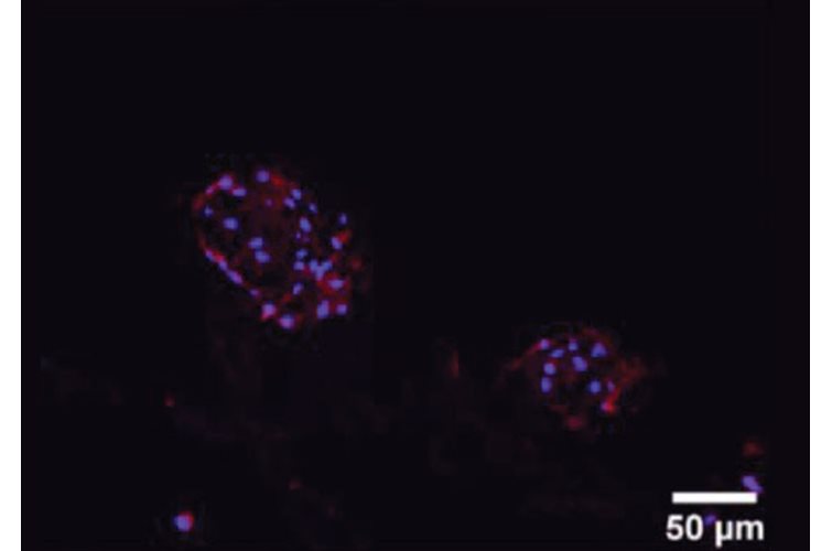Using PeptiInk&reg; Alpha-1&#8482; for bioprinting chondrocytes