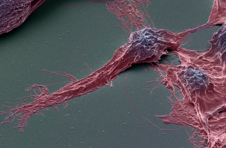 Exosomes in cancer management
