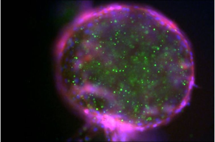 Green fluorescent protein: GFP legend and legacy