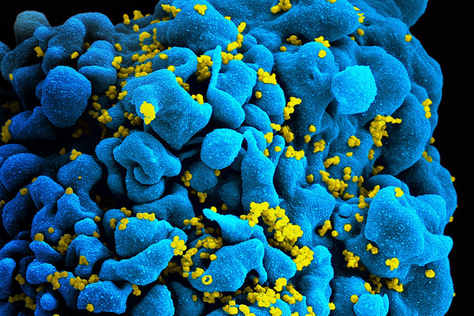 Can cytokines remove HIV's cloak?