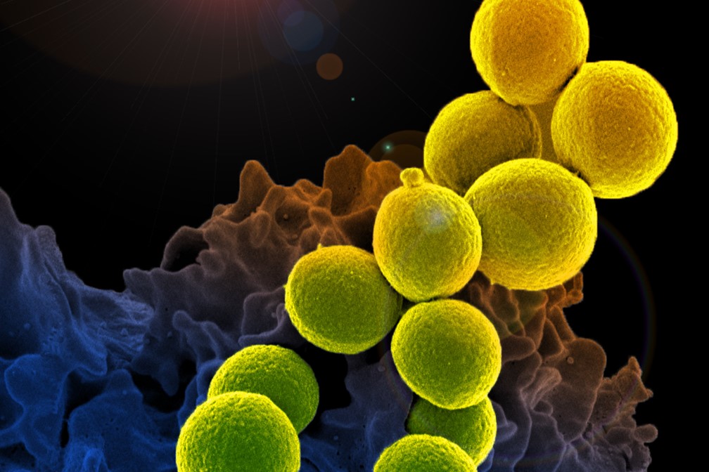 Anti-microbial resistance: fixing the innovation gap