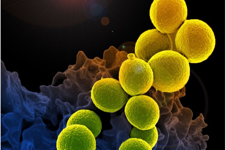 Anti-microbial resistance: fixing the innovation gap