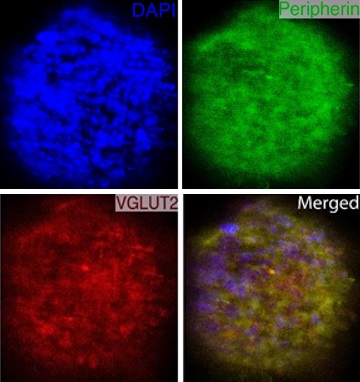 Listen up: Improving neurons for cochlear implants