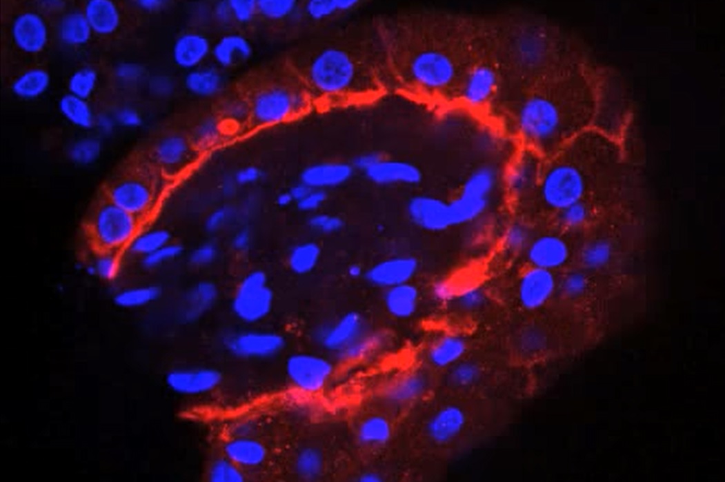 Refining 3D Cell Culture Systems for Drug Discovery