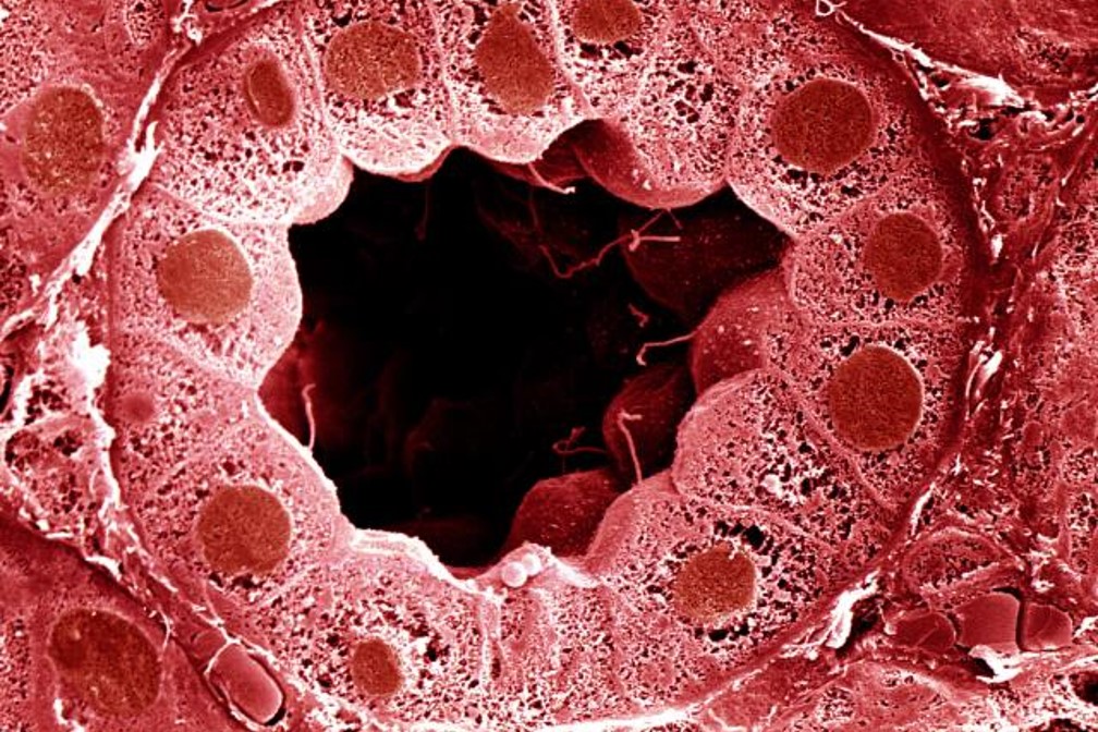 Combining techniques improves extracellular vesicle isolate quality