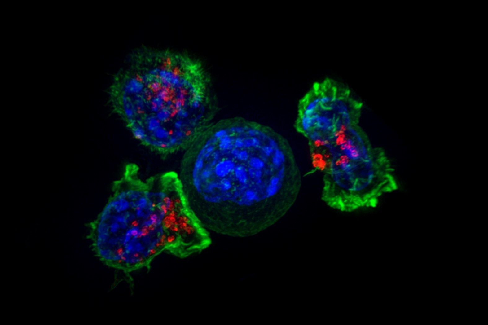 Immune checkpoint inhibitors' adverse events