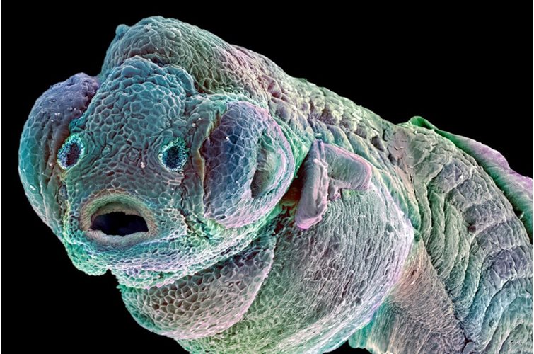 Zebrafish embryo surprised by morphogen cluster synergy