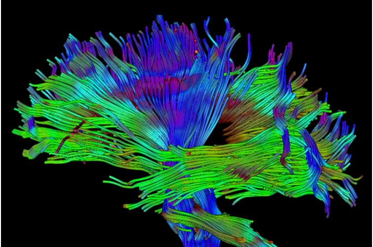 Could FGF17 rejuvenate the brain?