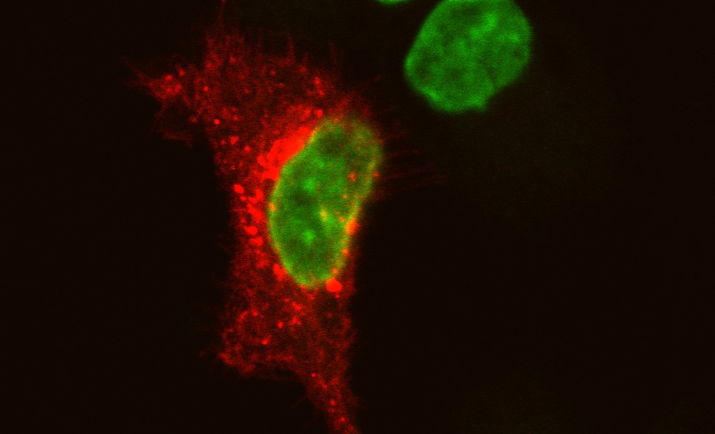 The importance of exosome characterization