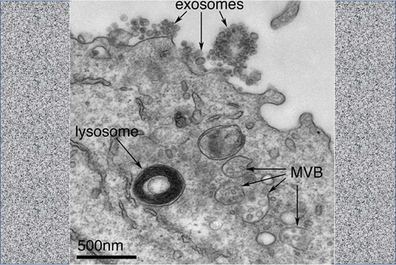 Exosome therapeutics in development for treating Covid