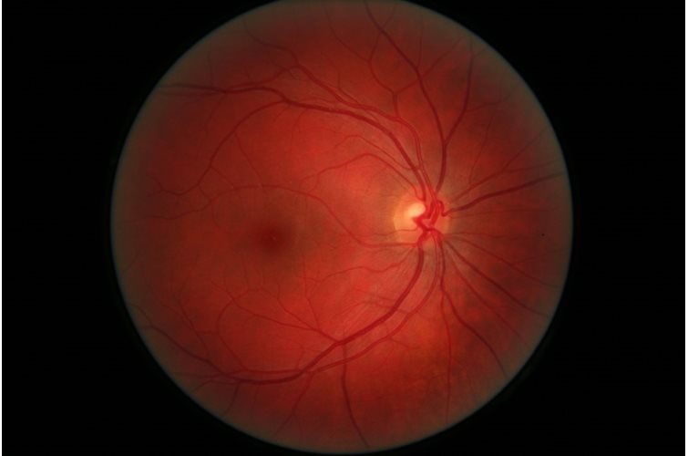 A clear vision for the future of curing retinal diseases