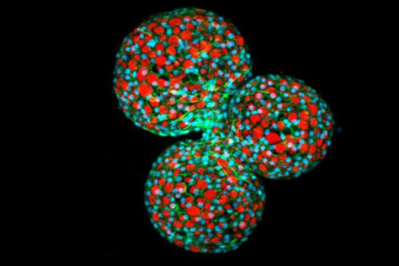 3Rs: Tiny amounts of Matrigel sufficient for  mammary epithelial cell organoids