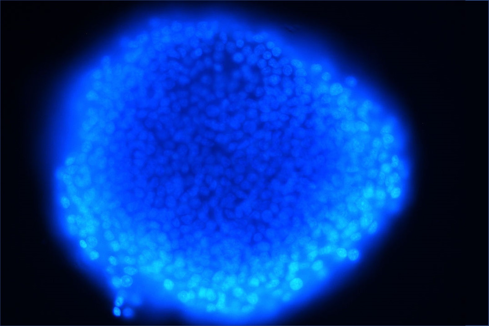 Membrane-less RNA compartments