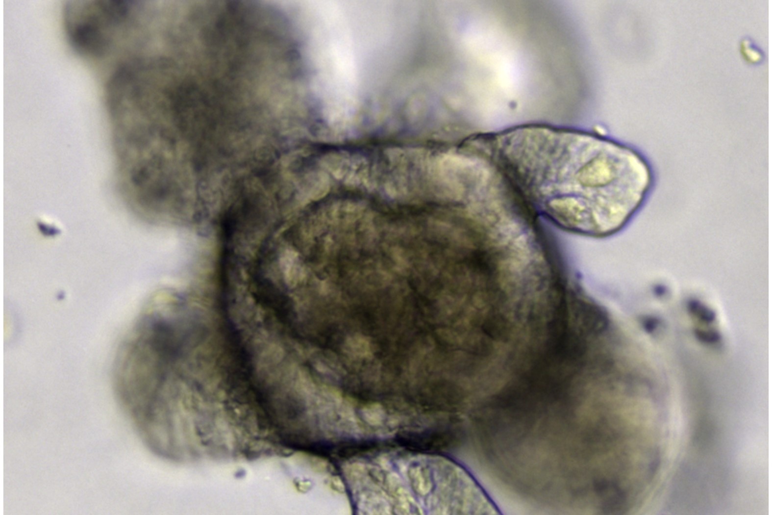 What's the difference: Organoids vs. Spheroids?
