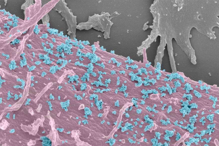 Exosomes in Parkinson's disease