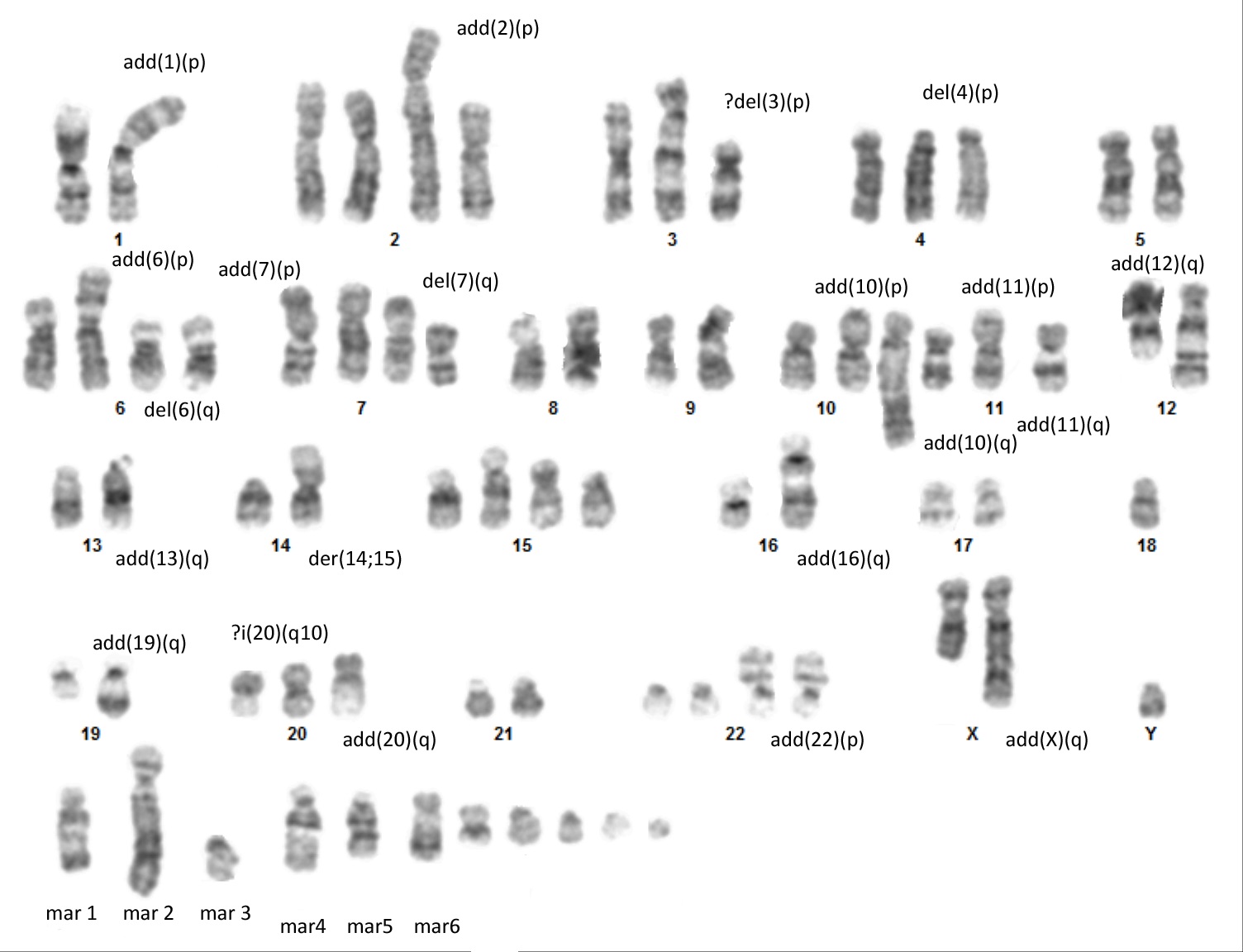 Karyotype