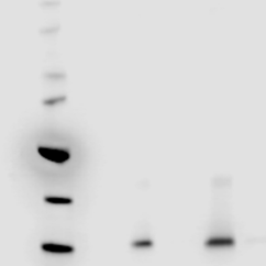 Exosome CD81 antigen antibodies