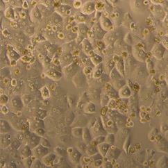 Primary Human Hepatocytes - Plateable Grade